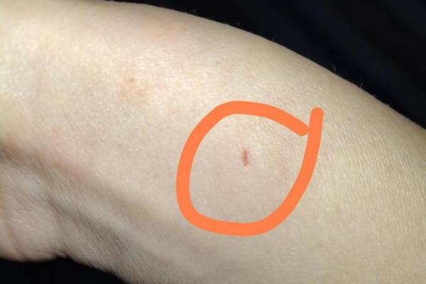 梦到被猫咬是什么征兆 男性 梦到被猫咬是什么征兆 男性