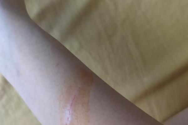 梦见被猫抓了 梦见被猫抓了