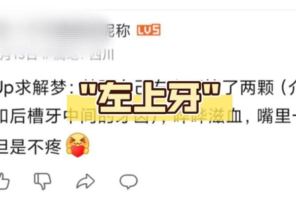 男人梦见掉上门牙是什么征兆 男人梦见掉上门牙是什么征兆